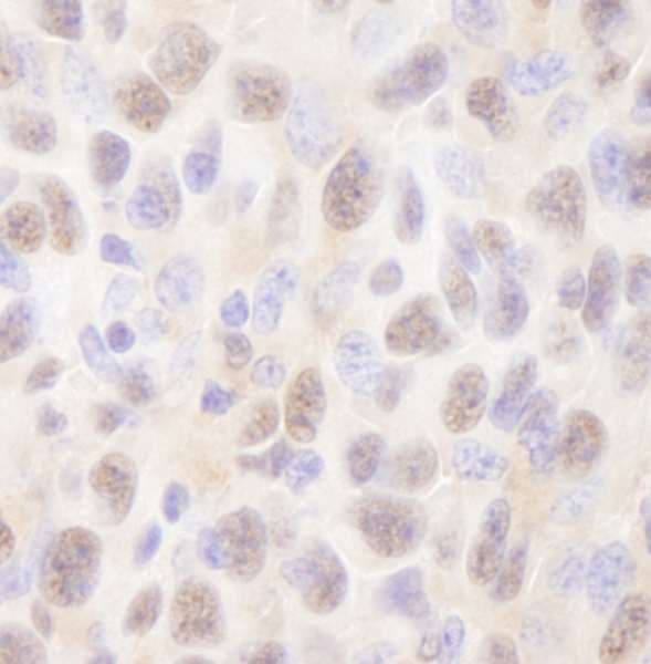 Polyclonal Rabbit anti-Human UBE2A Antibody (N-Terminus, IHC)