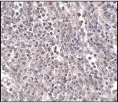 EBI3 / IL-27B Antibody