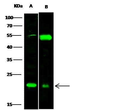 RBP4 Antibody (Preservative Free)