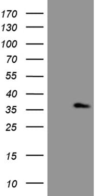 Monoclonal Mouse anti-Human ASB13 Antibody (clone OTI5G10, aa76-278, WB)