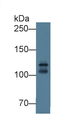CDH15 / M Cadherin Antibody (aa60-374)