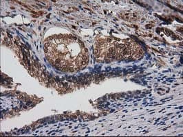 DSTN / Destrin Antibody (clone OTI1D5)