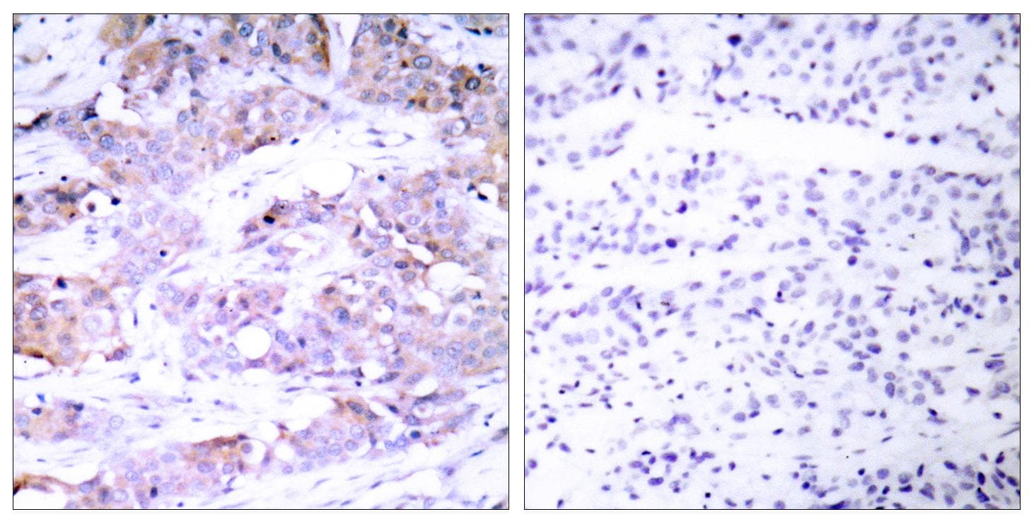 ELK1 Antibody (p417)