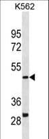 DHODH Antibody (aa166-194)