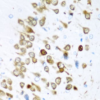 ELAVL3 / HUC Antibody