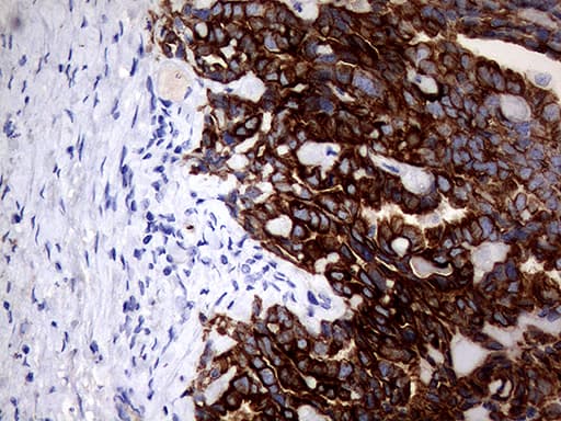 KRT18 / CK18 / Cytokeratin 18 Antibody (aa69-372, clone OTI10H8)
