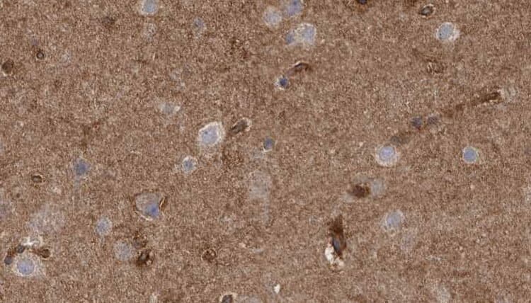 Polyclonal Rabbit anti-Human ClC-3 / CLCN3 Antibody (IHC, WB)