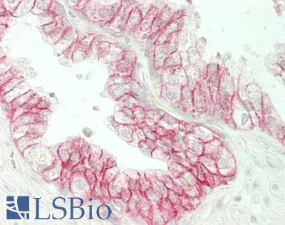 PathPlus™ Monoclonal Mouse anti-Human CTNNB1 / Beta Catenin Antibody (clone 14, IHC)