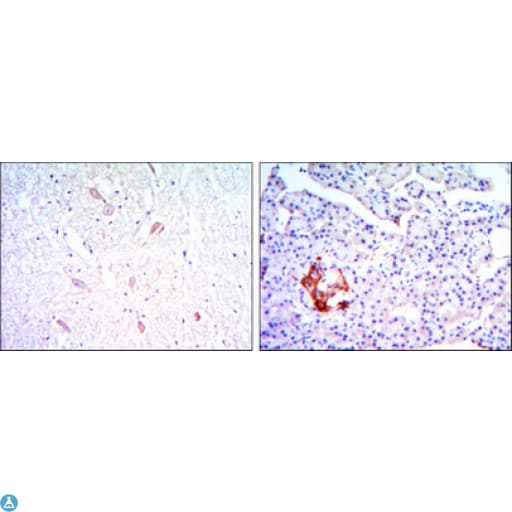 KLHL13 Antibody