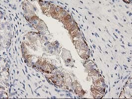 MGLL / Monoacylglycerol Lipase Antibody (clone OTI2C9, Carrier-free)