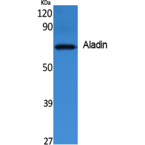 AAAS / Adracalin Antibody (360-440 aa, C-terminal)