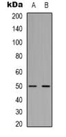 TUBB2A / Tubulin Beta 2A Antibody
