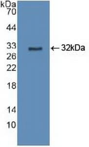CYP27B1 Antibody (aa256-508)