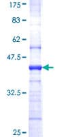 Human EIF4A2 Protein (Recombinant GST, N-terminus)