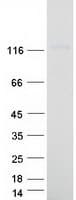 Human PCDH20 Protein (Recombinant Myc-DDK (Flag))
