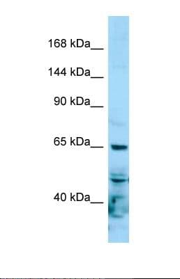 POLR2A / RNA polymerase II Antibody (aa161-210)