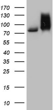R1 / RRM1 Antibody (aa541-792, clone OTI9A2)