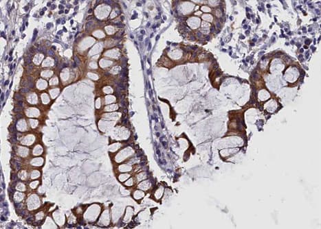 c-Met Antibody