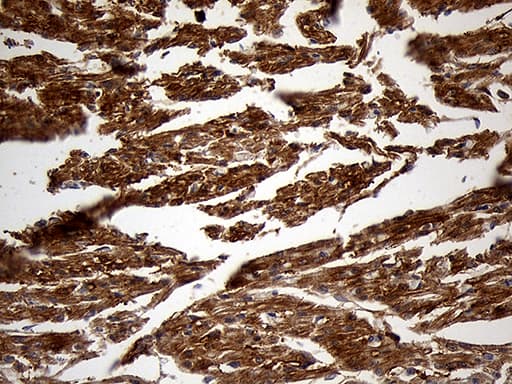 PYGM Antibody (aa698-842, clone OTI5D1)