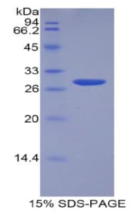 Human ADAM15 Protein (Recombinant His)
