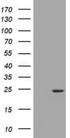 Monoclonal Mouse anti-Human VILIP / VSNL1 Antibody (clone OTI1B5, WB)