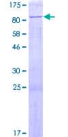 Human CTDSPL2 Protein (Recombinant GST)