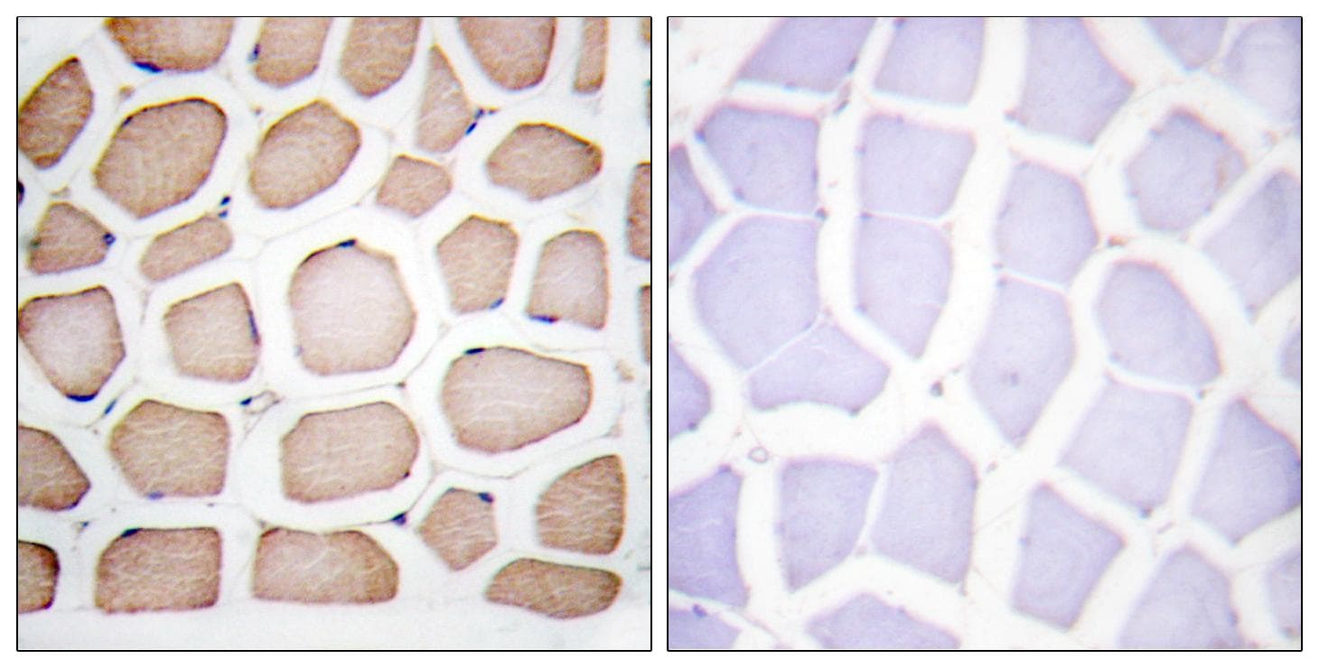 CFLAR / FLIP Antibody