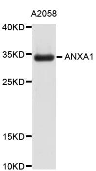 ANXA1 / Annexin A1 Antibody