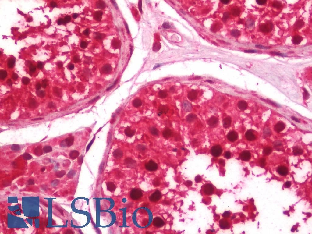 IHC-plus™ UBR7 / C14orf130 Antibody (aa1-50)