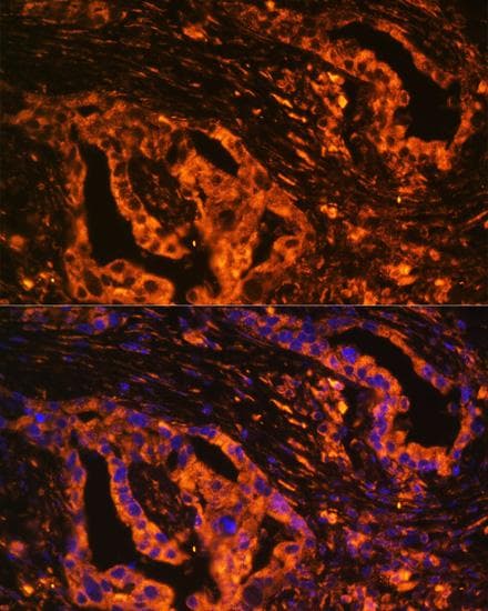 SCNN1A / ENaC Alpha Antibody