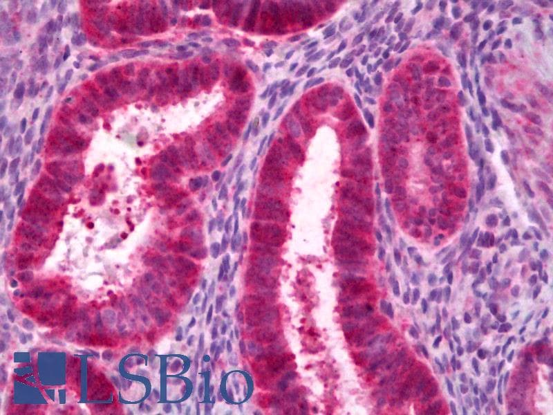 IHC-plus™ PCK1 Antibody