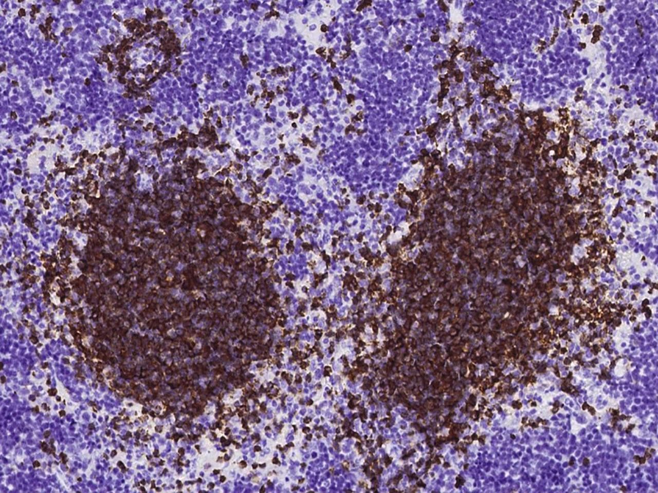 CD79B / CD79 Beta Antibody (clone 003, Preservative Free)