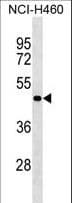 Polyclonal Rabbit anti-Human SGPP2 Antibody (aa7-33, WB)