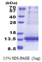 Human NDUFV3 Protein (Recombinant His)