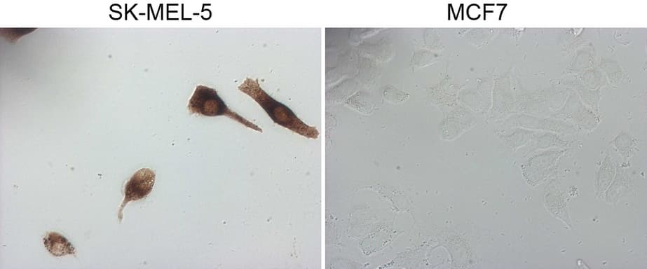 MLANA / Melan-A Antibody (aa48-118, clone OTI2E7, Carrier-free)