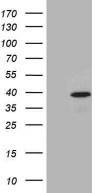 TOMM40L Antibody (clone OTI5D9)