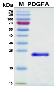 Mouse PDGF-AA Protein (Recombinant 6His, N-terminus)