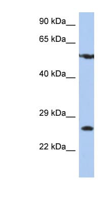 Polyclonal Rabbit anti-Human ZNF10 / KOX1 Antibody (aa107-156, WB)