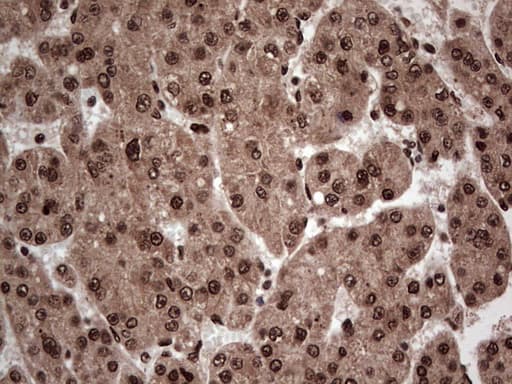 Monoclonal Mouse anti-Human SAE1 Antibody (clone OTI6B11, IHC, WB)