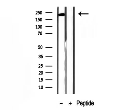MYH7 Antibody