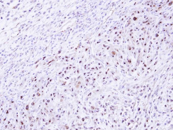 DRAK1 / STK17A Antibody (aa1-231)