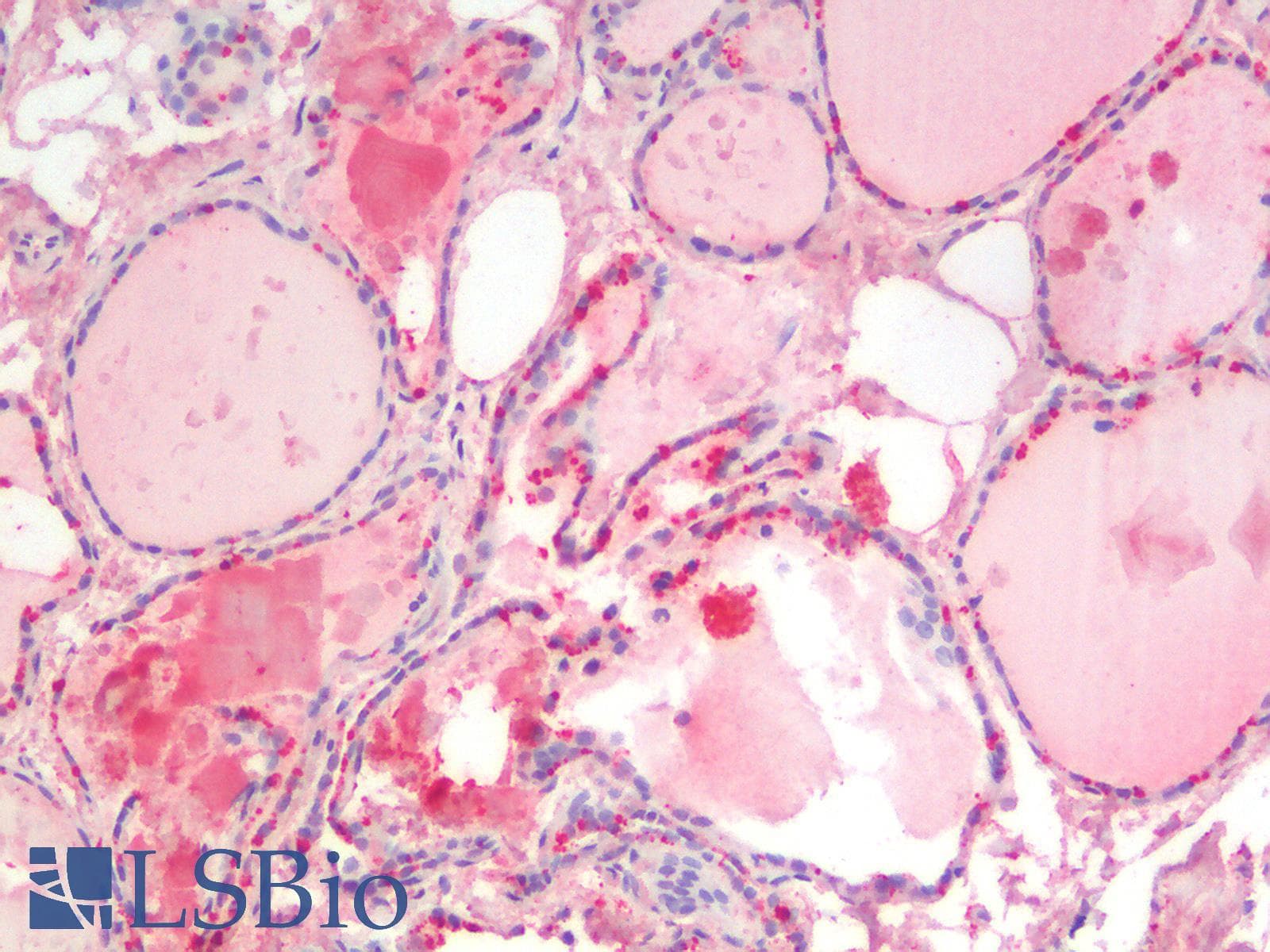 IHC-plus™ Polyclonal Goat anti-Human SGTA / SGT Antibody (Internal Region, IHC, WB)