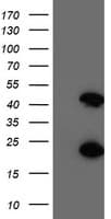 CENPH / CENP-H Antibody (clone OTI4G6)