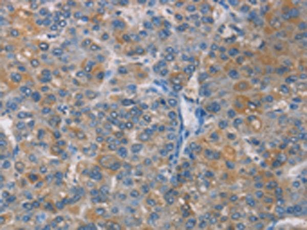 Polyclonal Rabbit anti-Human ZBTB1 Antibody (IHC)
