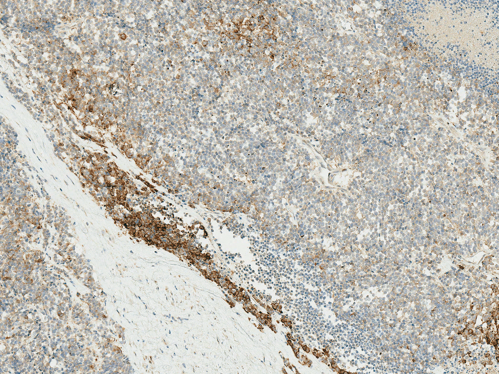 PIK3C3 / VPS34 Antibody