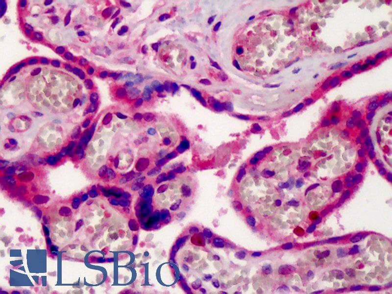 IHC-plus™ XPO1 / CRM1 Antibody (aa390-408)