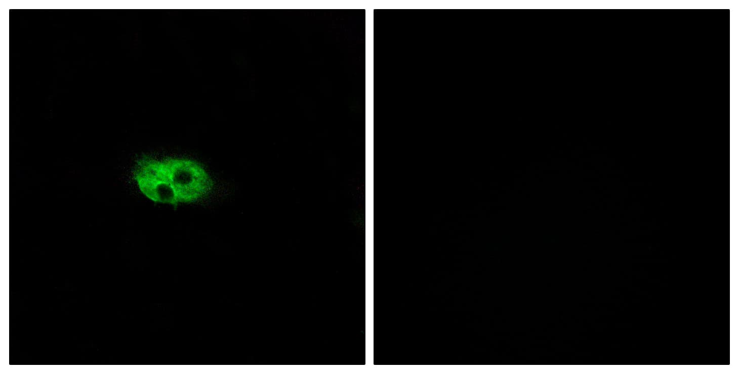 TACR3 / NK3R Antibody (aa401-450)