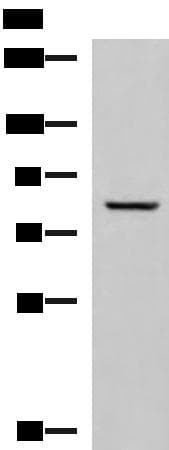 TGM3 / Transglutaminase 3 Antibody
