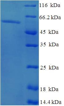 Human EXO5 / Exonuclease 5 Protein (Recombinant His-SUMO)