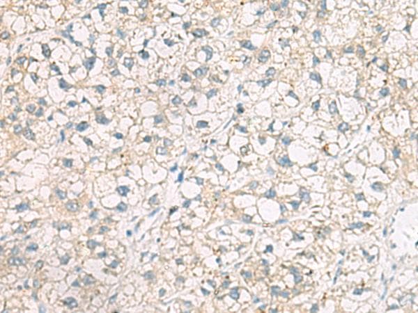 Polyclonal Rabbit anti-Human POFUT1 Antibody (IHC)